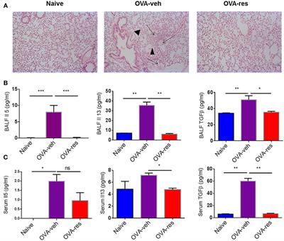 Resveratrol Attenuates Allergic Asthma and Associated Inflammation in the Lungs Through Regulation of miRNA-34a That Targets FoxP3 in Mice